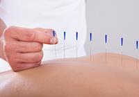Pesquisa: a acupuntura é mais eficaz no alívio da dor do que a morfina!