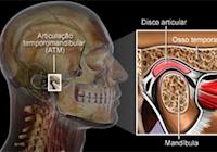 Protocolos terapêuticos de acupuntura validados na literatura para o tratamento de DTM de Origem Muscular: Uma Revisão Sistemática da Literatura