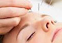 Uso da acupuntura estética e eletroacupuntura no tratamento de rejuvenescimento facial