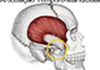 Acupuntura na Disfunção Têmporo Mandibular