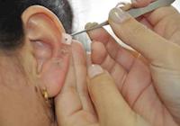 Estimular pontos da orelha pode ajudar contra problemas do dia a dia