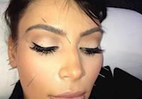 De Ivete a Kim Kardashian: 7 famosos que fazem acupuntura para viver melhor
