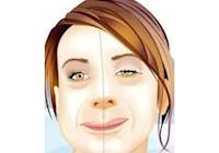 Tratamento da Paralisia Facial Periférica através da Acupuntura e da Fisioterapia