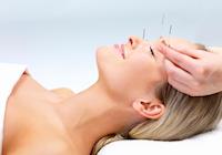 Tratamento com acupuntura combina saúde física e mental